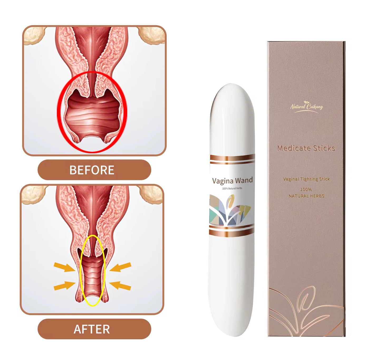 Medicate Sticks (Vaginal Tightening Stick)